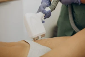 -50% на комплекси лазерної епіляції лише на першу процедуру