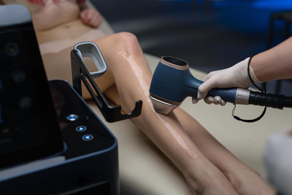 laserna-epilation